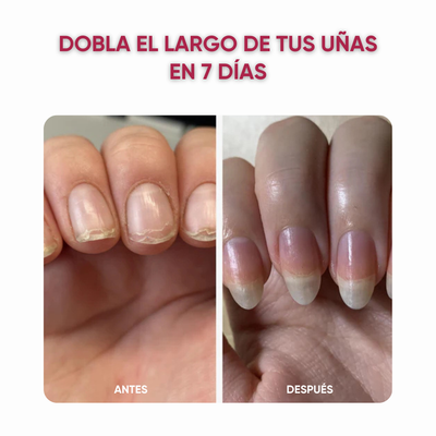 Uñas de titanio