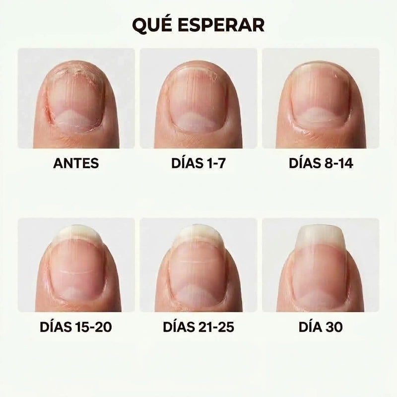 5. Favorece el crecimiento de las uñas y evita que crezcan quebradizas y secas.