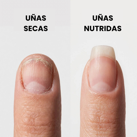 ¿Te quitaste las acrílicas y te quedaron las uñas delgadas, blandas y quebradizas?